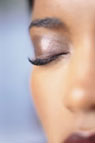 Blepharoplasty